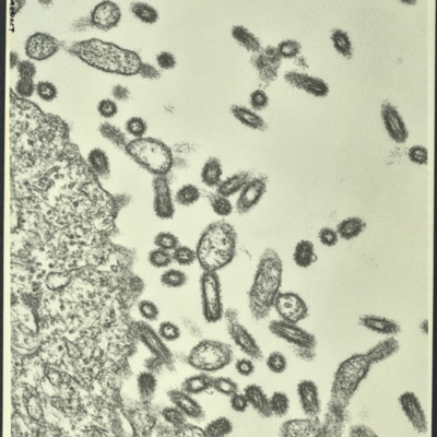 TEM of the reconstructed 1918 pandemic influenza virions budding form a cell, 2004